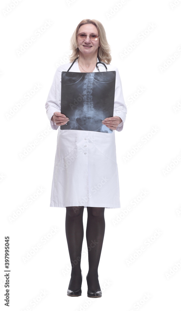 x-ray in the hands of a female therapist . isolated on a white x-ray in the hands of a female therapist . isolated on a white