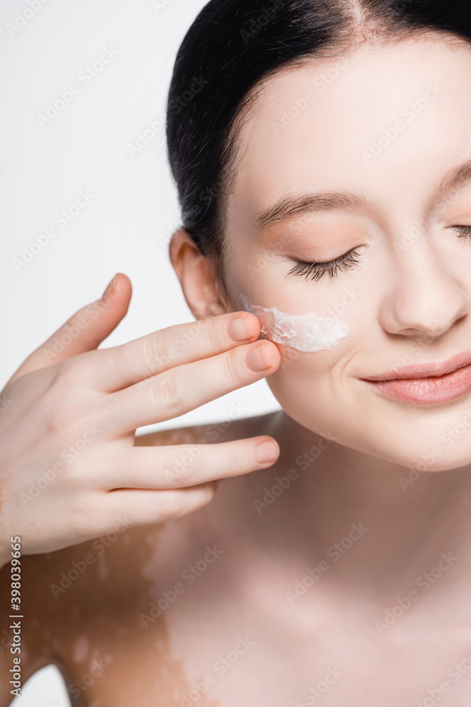 cropped view of young beautiful woman with vitiligo and facial cream on cheek isolated on white cropped view of young beautiful woman with vitiligo and facial cream on cheek isolated on white