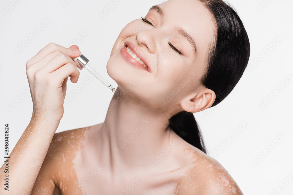 smiling young beautiful woman with vitiligo applyin smiling young beautiful woman with vitiligo applyin