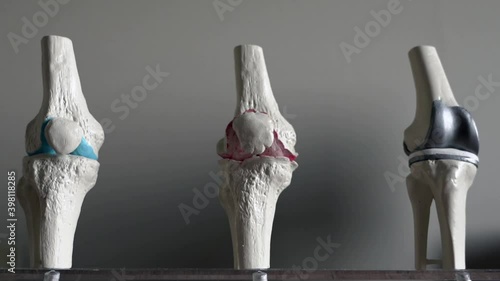 knee joint mockup. 