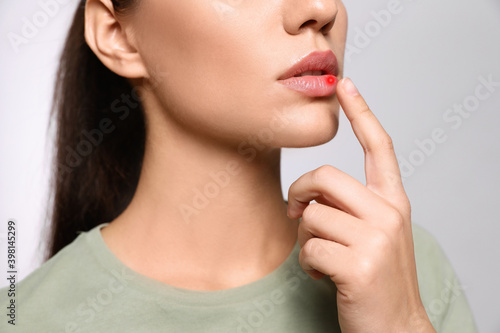Woman with herpes touching lip on light grey background, closeup