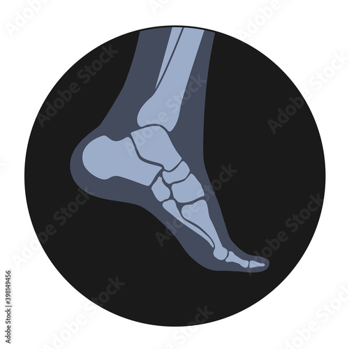 Human bones concept