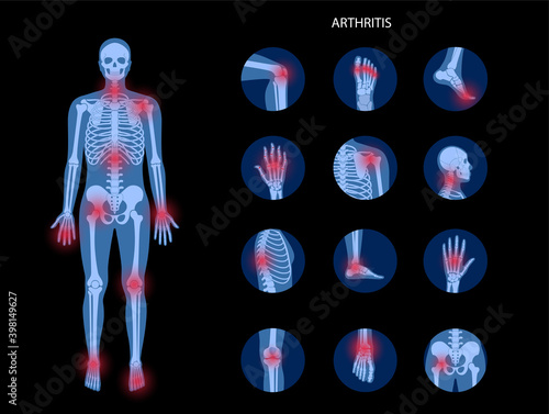Human bones concept