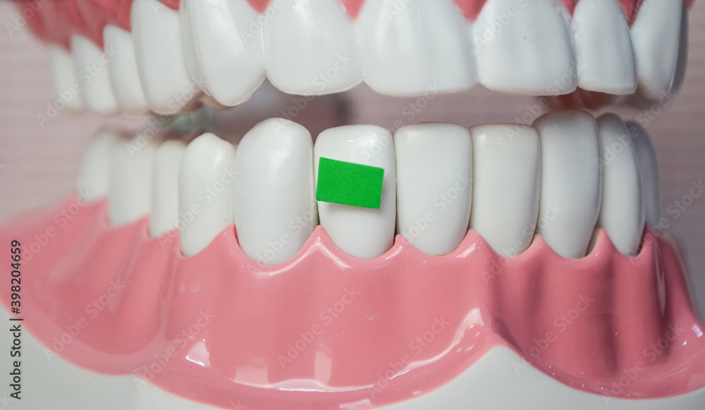 Obraz premium Green vegetables on the below teeth model.Dental care demonstration.Dental care concept.