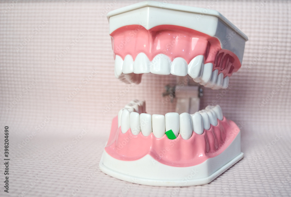 Green vegetables on the below teeth model.Dental care demonstration.Dental care concept. Green vegetables on the below teeth model.Dental care demonstration.Dental care concept.