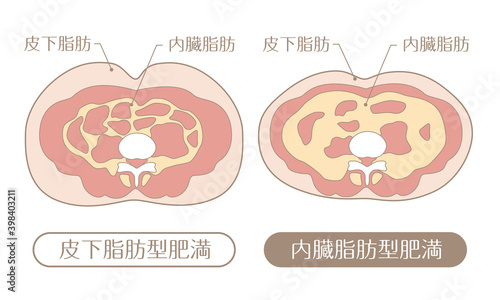 肥満のタイプ　皮下脂肪と内臓脂肪（文字あり）