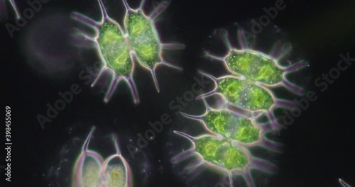 Protozoa and Green Algae in waste water under the microscope.
