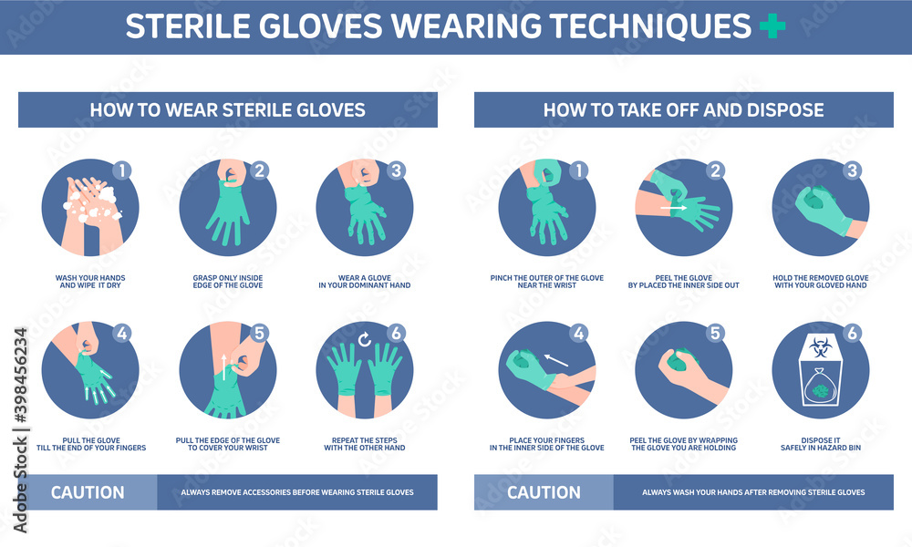 Infographic illustration of Sterile gloves wearing techniques, how to wear  gloves. Flat design. Stock Vector | Adobe Stock