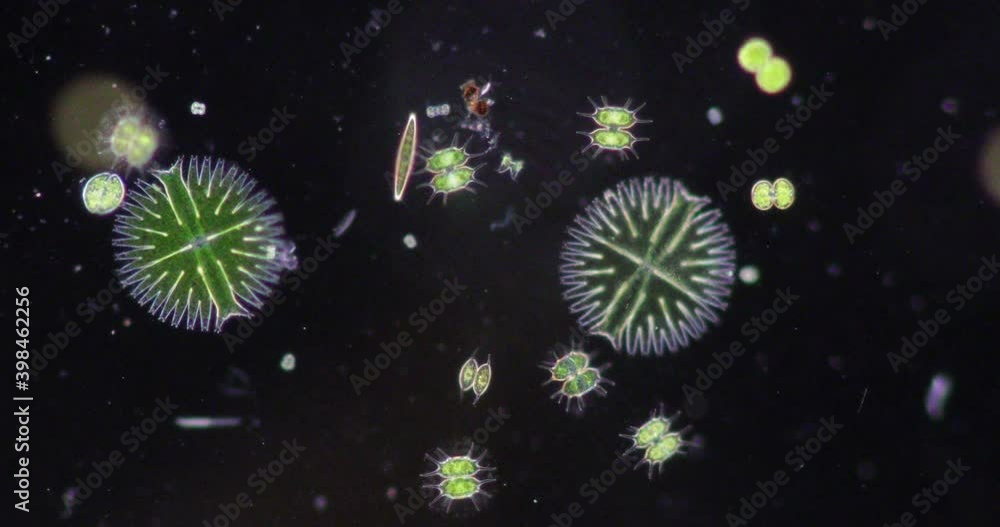 Protozoa and Green Algae in waste water under the microscope. Stock ...