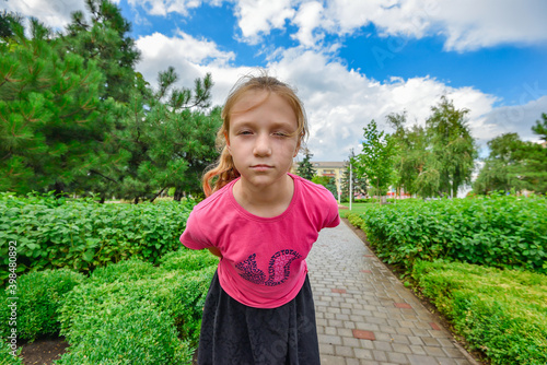 An emotional girl in the park among green leaves looks into a wide-angle camera.