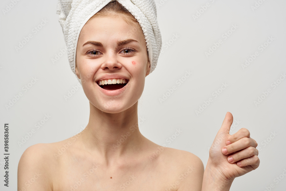 women in a towel and with pimples on their face gesturing with their hands clean skin acne women in a towel and with pimples on their face gesturing with their hands clean skin acne