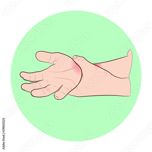 image graphics vector outline Wrist pain is often caused by sprains or fractures from sudden injuries concept health care