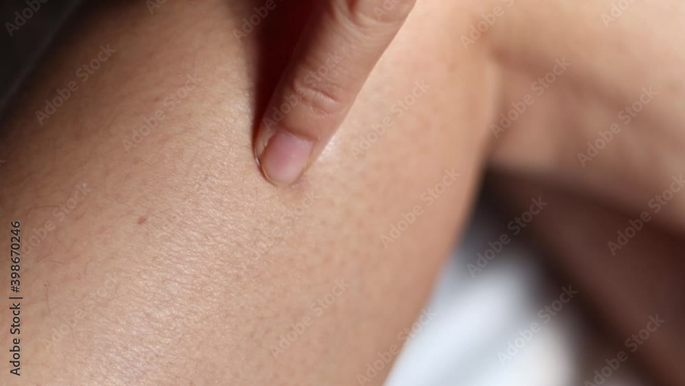 woman used her hand to apply the wound to her skin