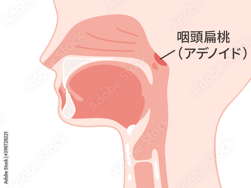 頭部_矢状断_アデノイド_咽頭扁桃のイラスト