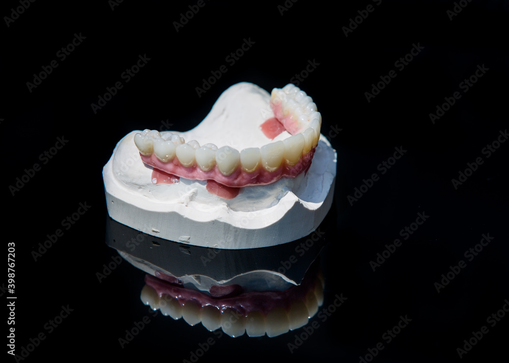 Ceramic teeth dental crowns model on black background.