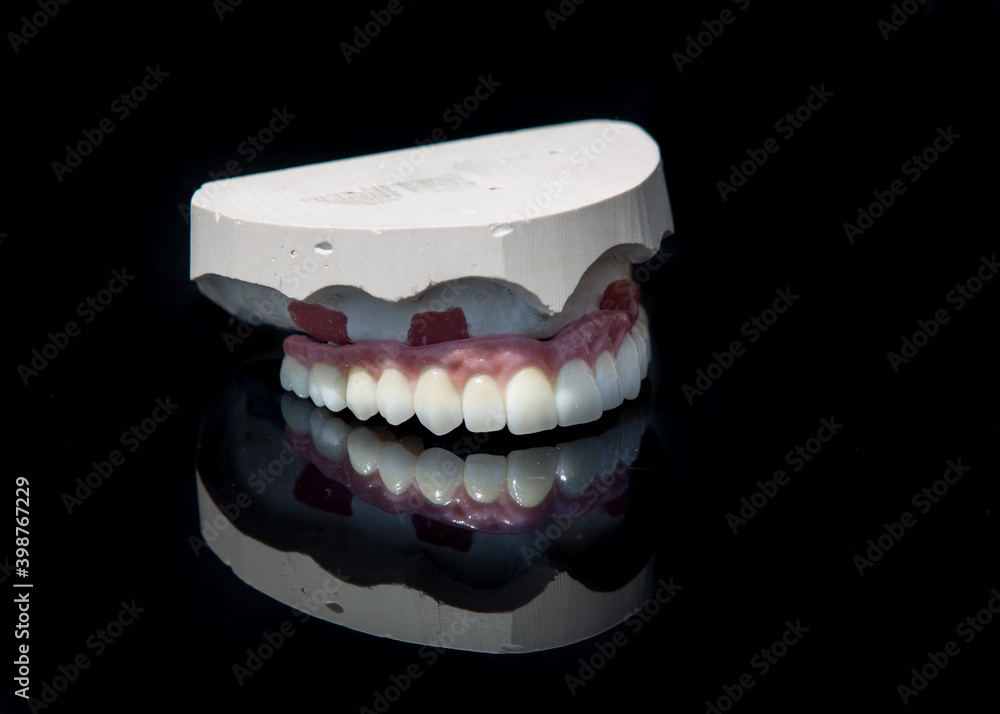 Ceramic teeth dental crowns model on black background.