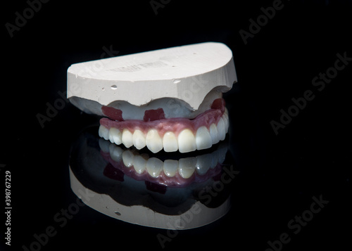 Obraz na płótnie Ceramic teeth dental crowns model on black background. w salonie