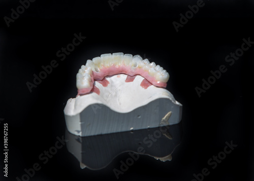Obraz na płótnie Ceramic teeth dental crowns model on black background. w salonie