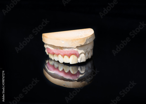 Obraz na płótnie Ceramic teeth dental crowns model on black background. w salonie