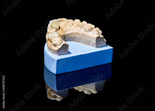 Obraz na płótnie Ceramic teeth dental crowns model on black background. w salonie