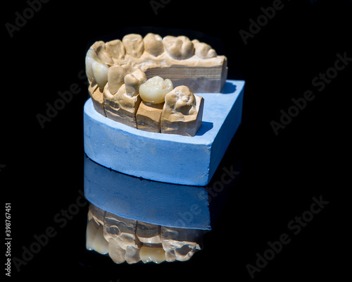 Ceramic teeth dental crowns model on black background.