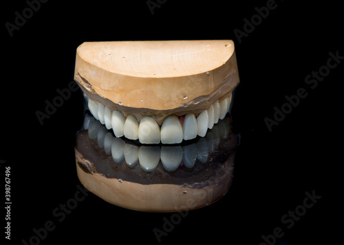 Obraz na płótnie Ceramic teeth dental crowns model on black background. w salonie