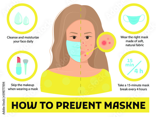 How to prevent Maskne tips - acne or irritation caused by wearing protective face mask during Coronavirus pandemic. Infographic vector illustration isolated. female character portrait with pimples