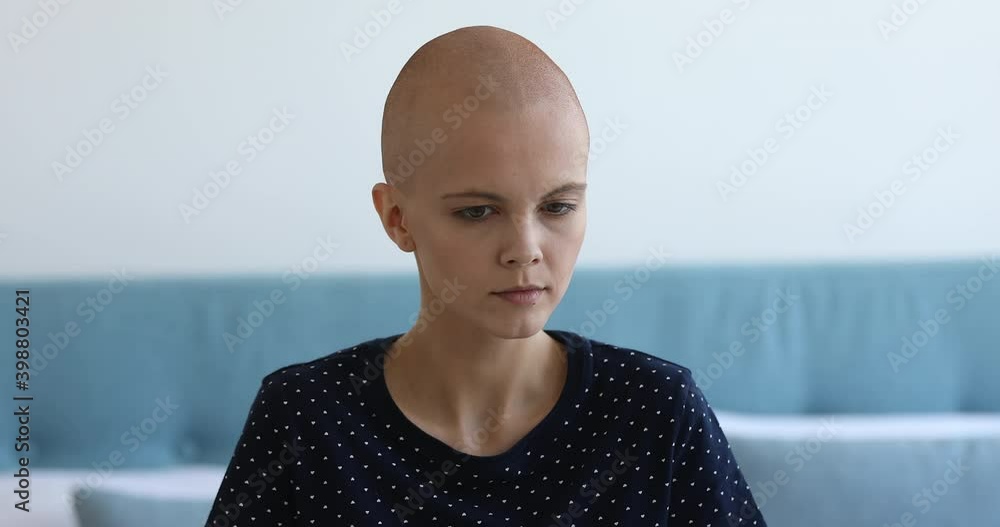 Head shot close up young pretty bald woman chemotherapy female patient ...