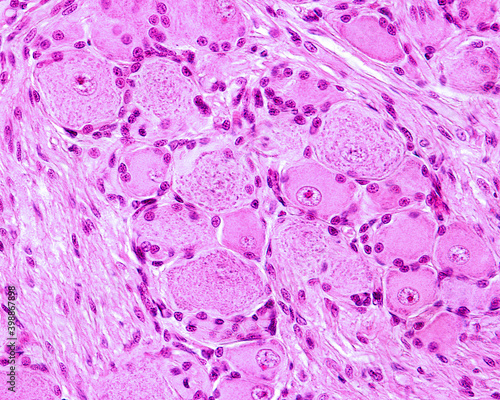 Canvastavla Pseudounipolar neurons. Dorsal root ganglion