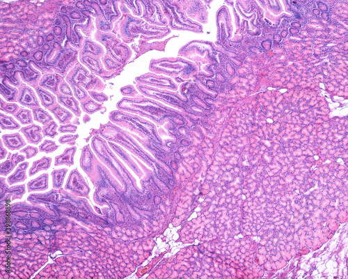 Duodenum. Brunner’s glands photo