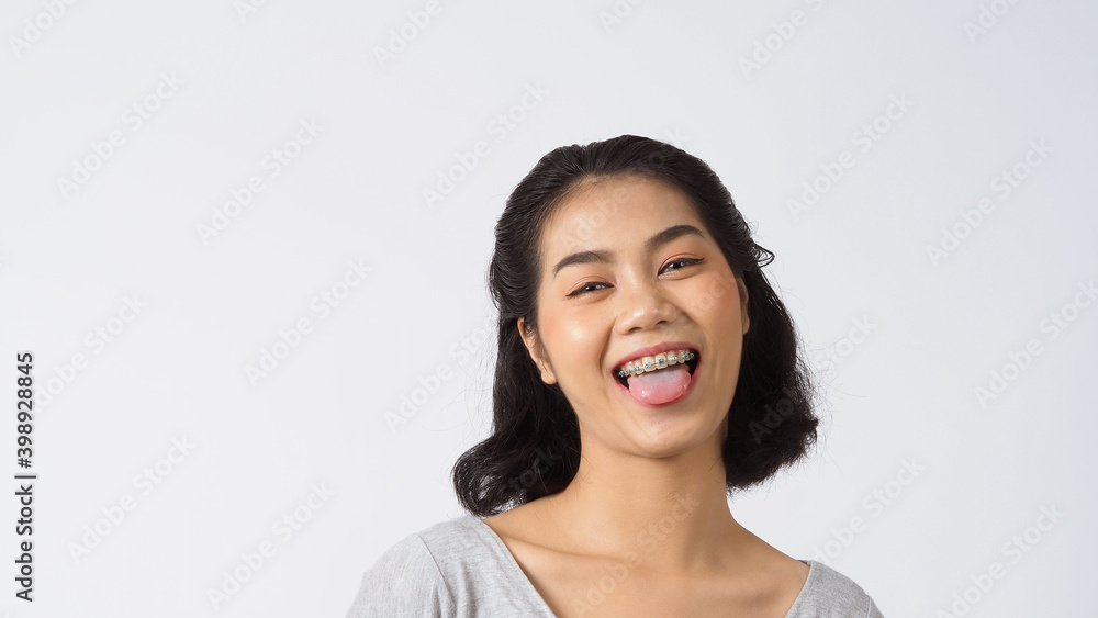 Dental brace beautiful girl smiling looking on a camera. white teeth with blue braces. Dental care. Asian teen woman smile with orthodontic accessories. Cosmetic dentistry, orthodontics treatment. Dental brace beautiful girl smiling looking on a camera. white teeth with blue braces. Dental care. Asian teen woman smile with orthodontic accessories. Cosmetic dentistry, orthodontics treatment.