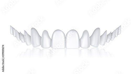 White denture. Realistic human teeth. Upper jaw. Oral care and hygiene. Implanting prosthetic or prevention and treatment. Dental clinic and medical service advertising. Vector isolated illustration