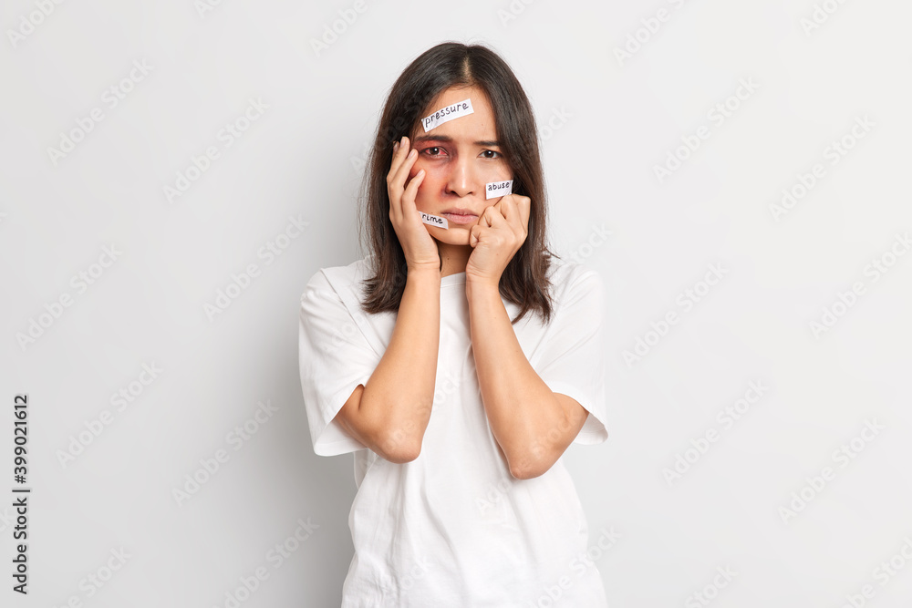 Panicked frustrated woman becomes victim of savage attack has bruize under eye severe head trauma becomes victim of abuse faces pressure and violence isolated over white background. Beaten female Panicked frustrated woman becomes victim of savage attack has bruize under eye severe head trauma becomes victim of abuse faces pressure and violence isolated over white background. Beaten female
