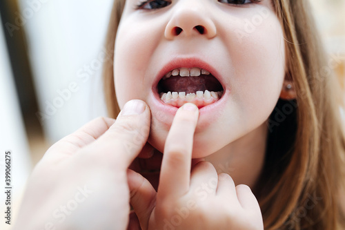 Close up portrait of daughter face, she shows tooth growth to his father.