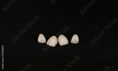 dental ceramic crowns, laminate veneers. photo