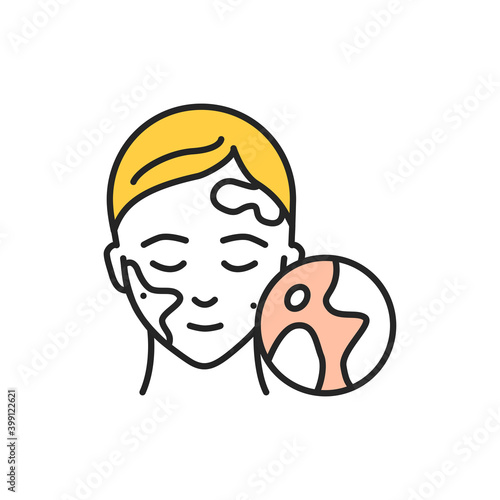 Vitiligo line color icon. Sign for web page, mobile app