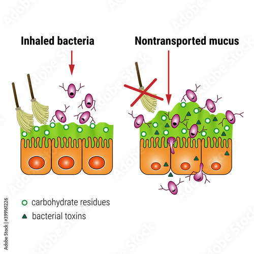 Bacterial interaction with respiratory mucus. Mucociliary transport. Respiratory pathogens release factors. Medical vector illustration