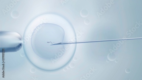 Scientific vector illustration with artificial insemination photo