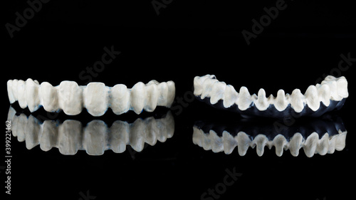 titanium dental bars for ceramic dentures of the upper and lower jaws on black glass with reflection