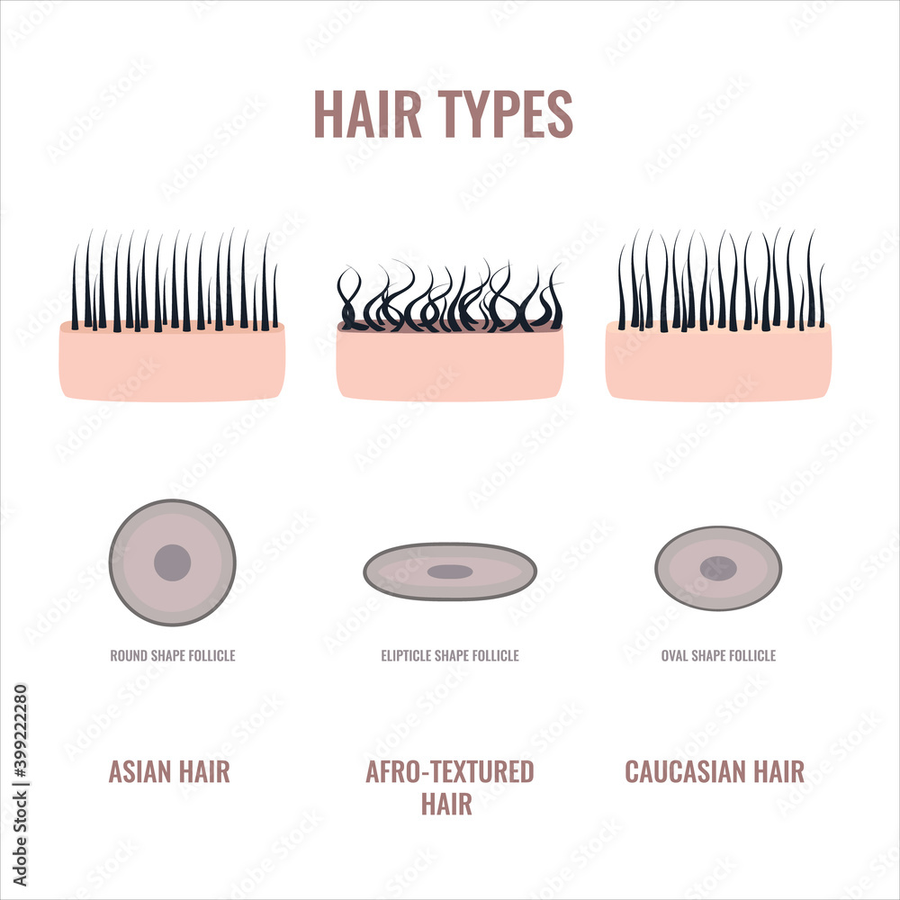 Straight, wavy and curly hair types classification set. Skin and follicles  cross-section diagram. Human hair growth style chart. Round, oval,  elliptical shapes of hair fiber. Vector illustration. Stock Vector | Adobe  Stock