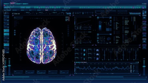 Holographic futuristic interface analyzing human brain anatomy and morphology. Medical profile of patient, brain lobes, neuron cell animation. Nerve impulses, EEG, electrical activity of the brain.