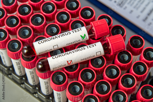 Blood test tubes for COVID-19 on vacuum tubes with blood samples. Blood test for the presence of antibodies to the causative agent of a new coronavirus infection.