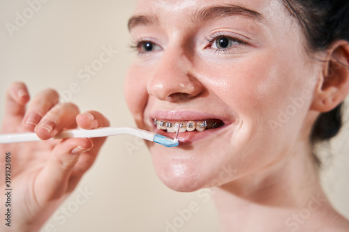 Woman clean teeth with dental braces