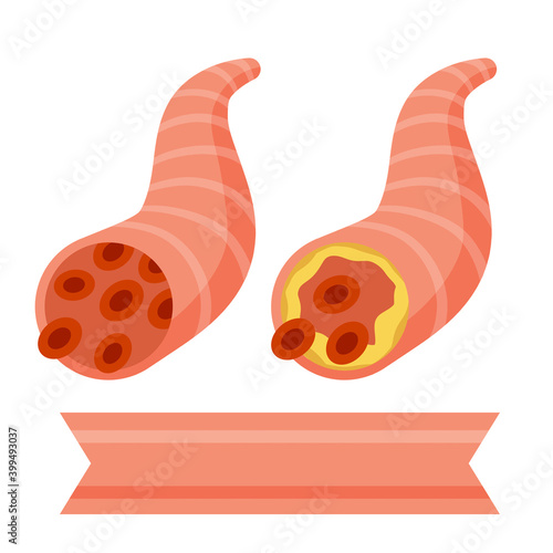 Cholesterol. Fat in arteries. Structure of blood vessels.