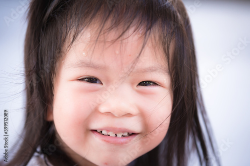 Headshot adorable Asian little child girl sweet smile. Kid has anterior cavities. Children feels hot, there is sweating on his forehead.