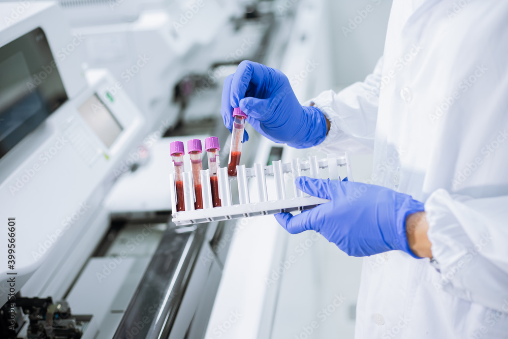 Scientist wear glove holding test tube in sample rack to check qulity of sample. Scientist wear glove holding test tube in sample rack to check qulity of sample.
