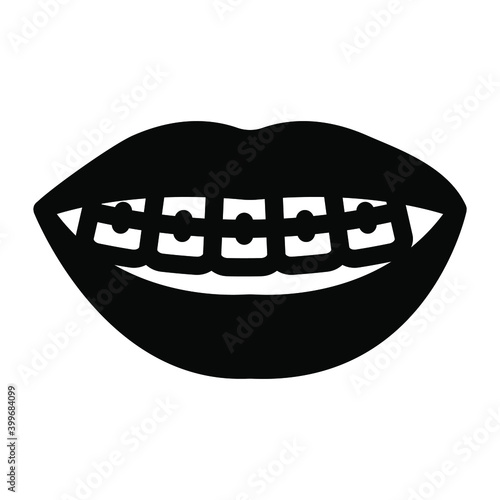 
Dental braces to align and straighten teeth 
