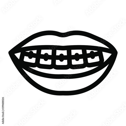 
Dental braces to align and straighten teeth 
