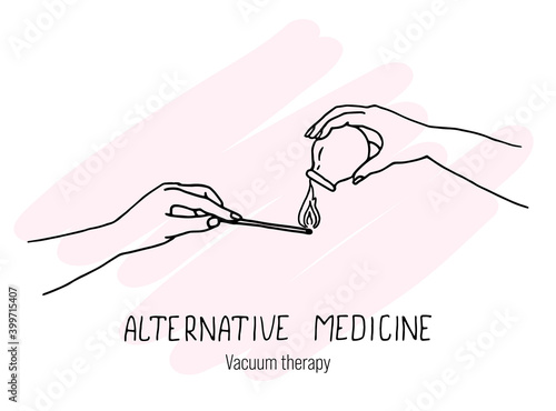 Therapeutic manipulations for vacuum procedures at home.