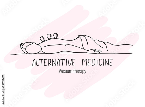 The girl is undergoing vacuum therapy. Alternative medicine.